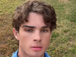 'Jestermaxxing' is weird new pattern following on from folks hitting their faces with hammers