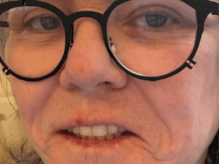 Comic Rosie O'Donnell shares candid pics of 'shameful' facelift that prices greater than any automotive she's purchased