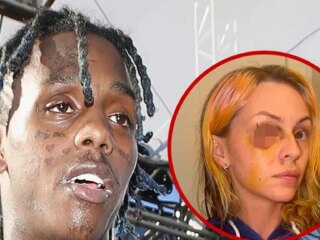 Famous Dex Accused of Giving Reality Star Ex Black Eye, Photos Emerge