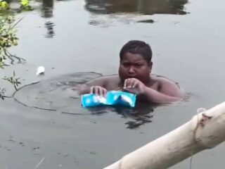 Indian Teen Who Lived in Ponds Has Rare Skin Disorder