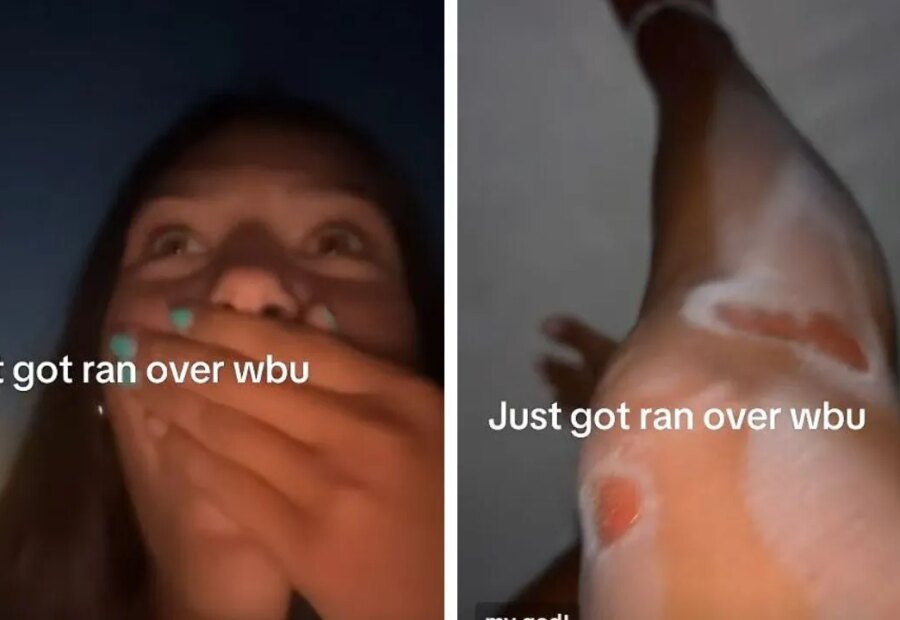 ‘Why Are You Not Crying?’ Woman’s Calm Reaction After Being Hit by Car Sparks TikTok Debate