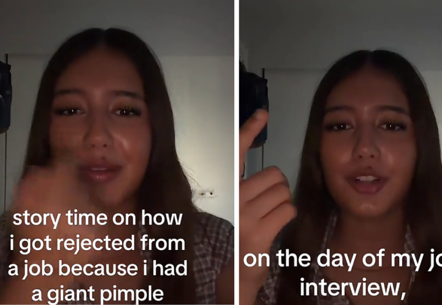Woman Rejected for Job After Interview Over Pimple: ‘We Take Pride in Appearance’